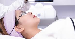 Công nghệ laser CO2