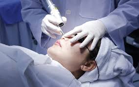 Công nghệ Laser Toning